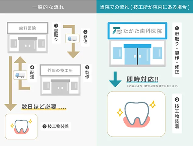 一般的な流れと、院内技工所がある場合の流れ